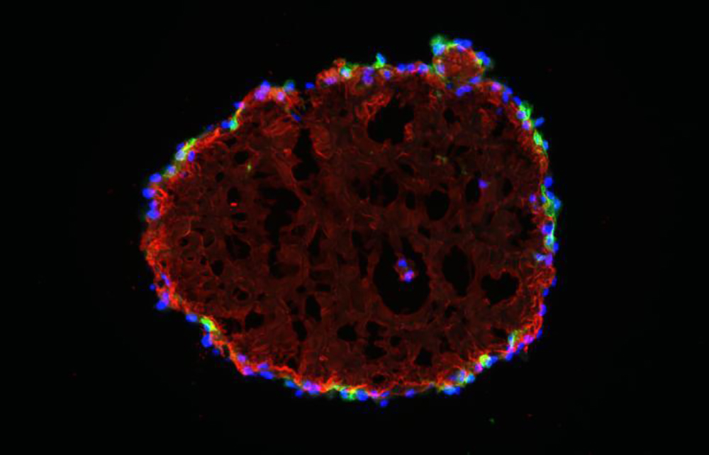 Long-lived Inverted Organoids Offer Better Glimpse Into Kidney Disease  Open Primary tabs…