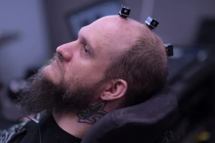 Side-profile view of a person seated in a chair with multiple small electronic modules attached to the scalp, illustrating an implanted computer–brain interface used for neural communication.