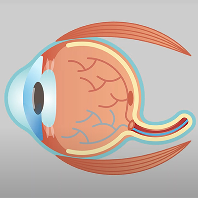 Cross-section diagram of the human eye showing internal structures including the cornea, lens, retina, and optic nerve.