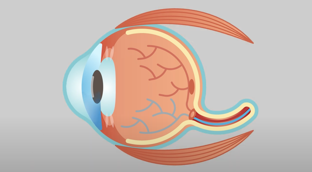 Under Pressure: Georgia Tech Researchers Discover a New Way to Treat Glaucoma