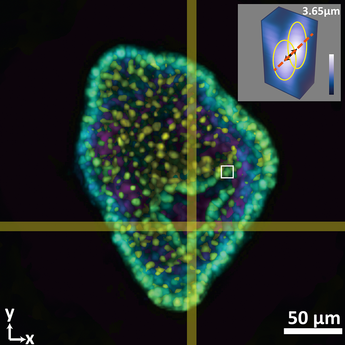 This composite image shows a colon organoid with stained cell nuclei reconstructed from a raw image taken by a new system developed in the Coulter Department. The large image shows depth color coded from yellow (-56.2 micrometers from the focal plane) to purple (+56.2 micrometers from the focal plane). The inset shows a tight crop of the distance between two cells of 3.65 micrometers. The single raw image was captured in 0.1 seconds. (Image Courtesy: Shu Jia &amp; Wenhao Liu)