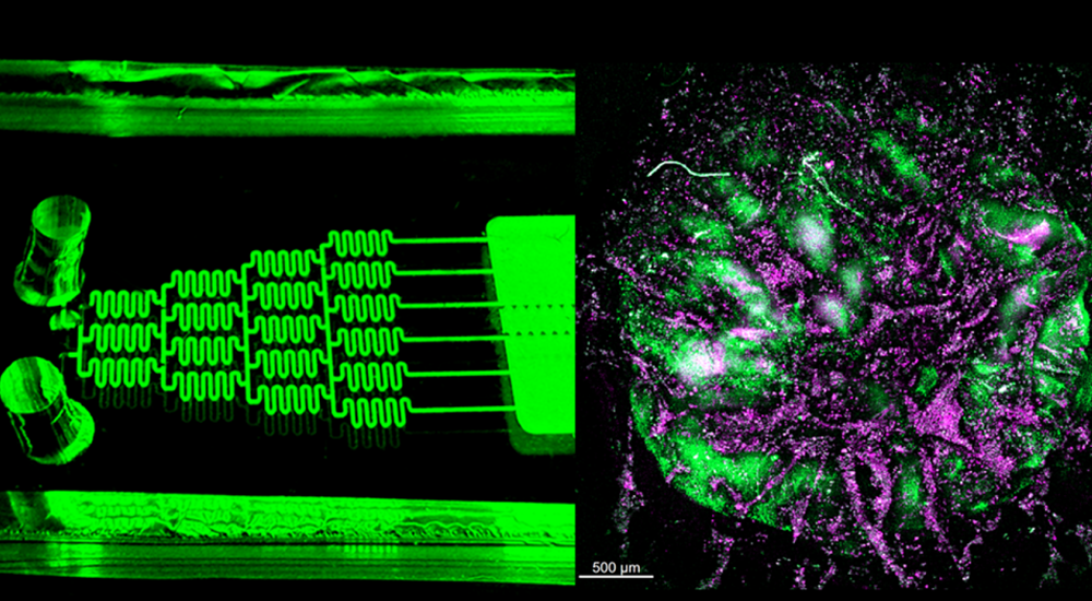 Lab-Grown Human Immune System Model Uncovers Weakened Response in Cancer Patients