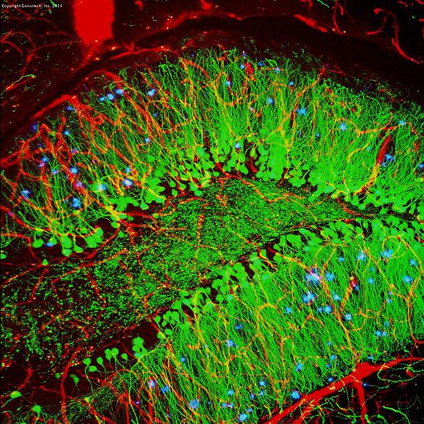 <p>Along with blood vessels (red) and nerve cells (green), this mouse brain shows abnormal protein clumps known as plaques (blue). Georgia Tech / Levy Wood</p>