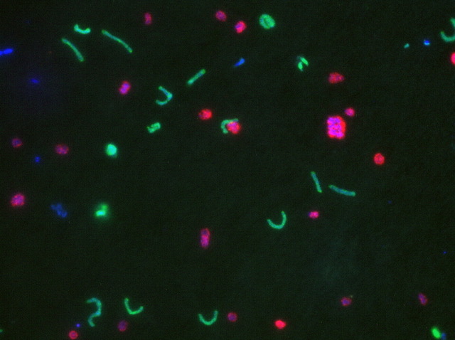 A microscopy image of bacteria highlighted in green, pink, and indigo colors.