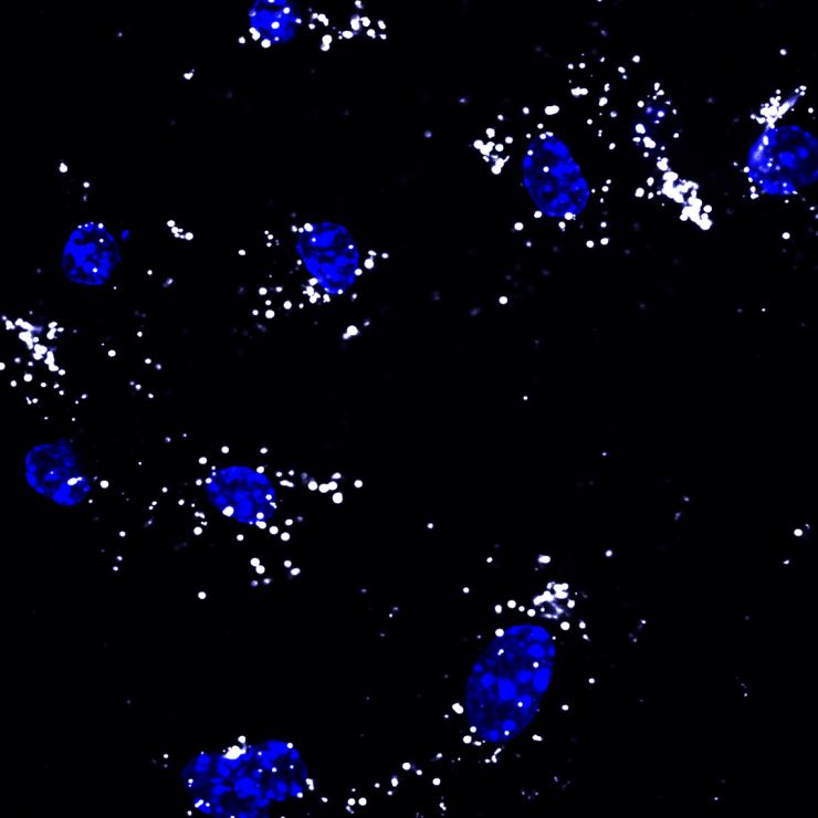 <p>CpG-loaded polymer carriers trigger robust toll-like receptor 9 signaling in dendritic cells. (Image courtesy Jardin Leleux, Georgia Tech)</p>