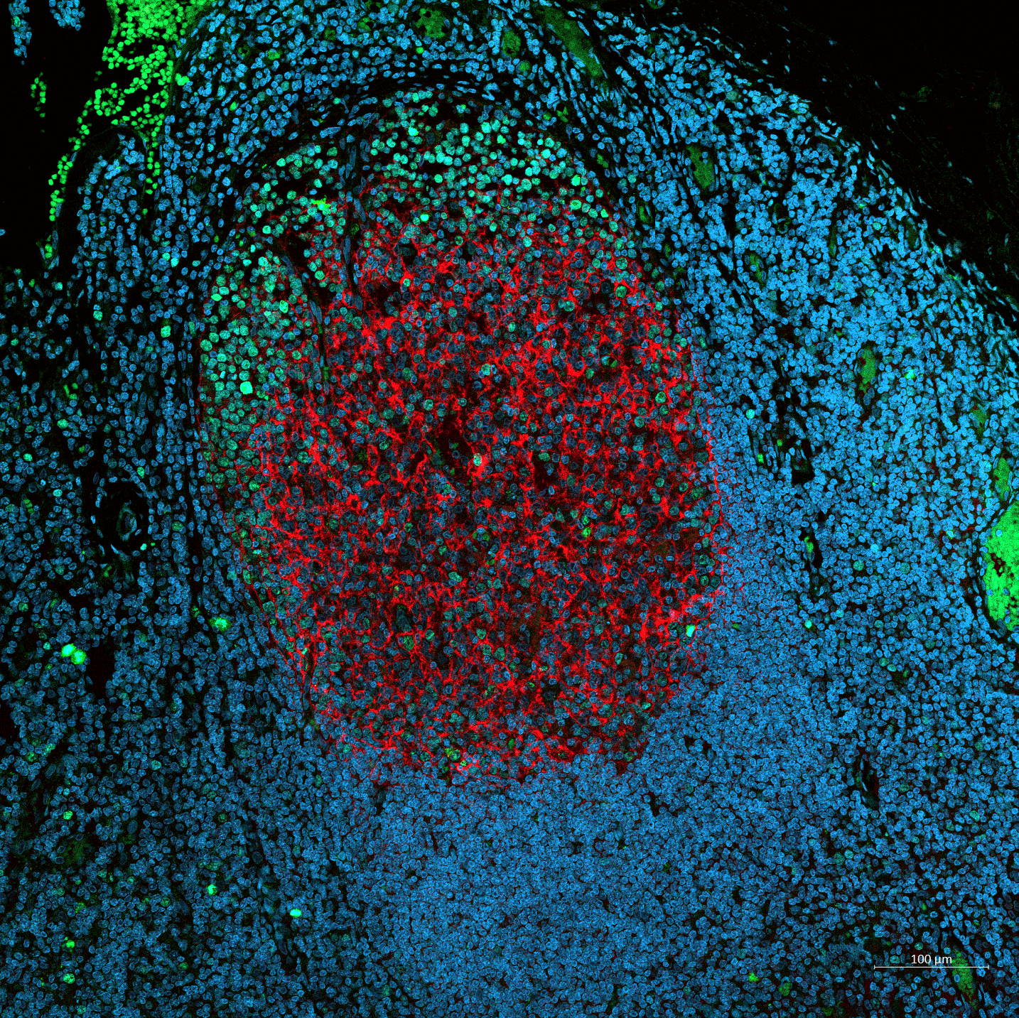 Microscopy image of a human tonsil organ with B cell follicle and surrounding cells. The image shows stromal cells (red), proliferative B cells (green), and the nucleus (aqua blue). (Credit: Deepali Balasubramani/Ankur Singh)