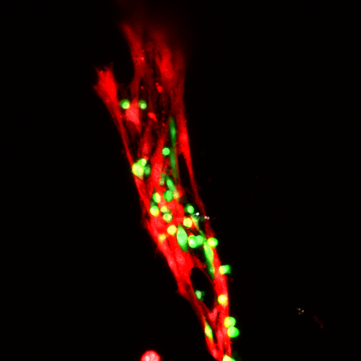 <p>Muscle satellite (stem) cells, in green, affixed to an injured muscle strand by the nanohydrogel.</p>