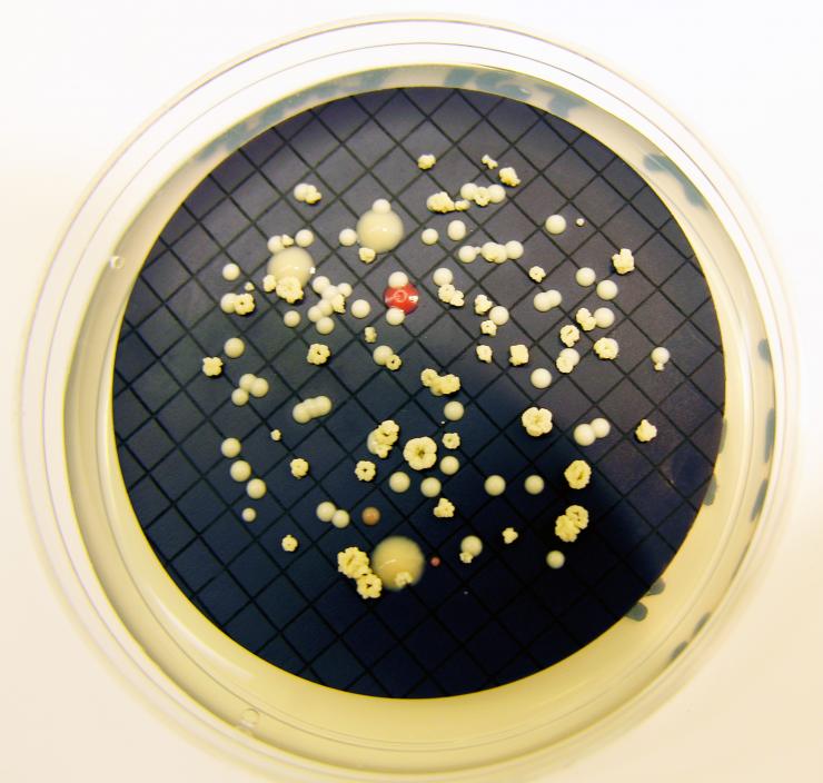 <p>Image shows the growth of Mycobacterium isolated on a plate of culture medium. (Credit: Stacey Pfaller, EPA)</p>