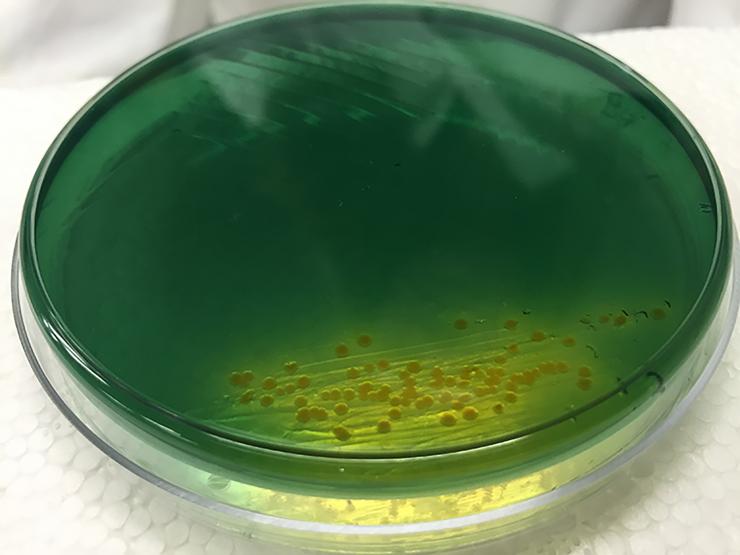 <p>Image shows cholera colonies (yellow) growing on an agar plate. Growth of the bacterium was part of research into the diversity and resourcefulness of the bacterium. (Credit: John Toon, Georgia Tech)</p>