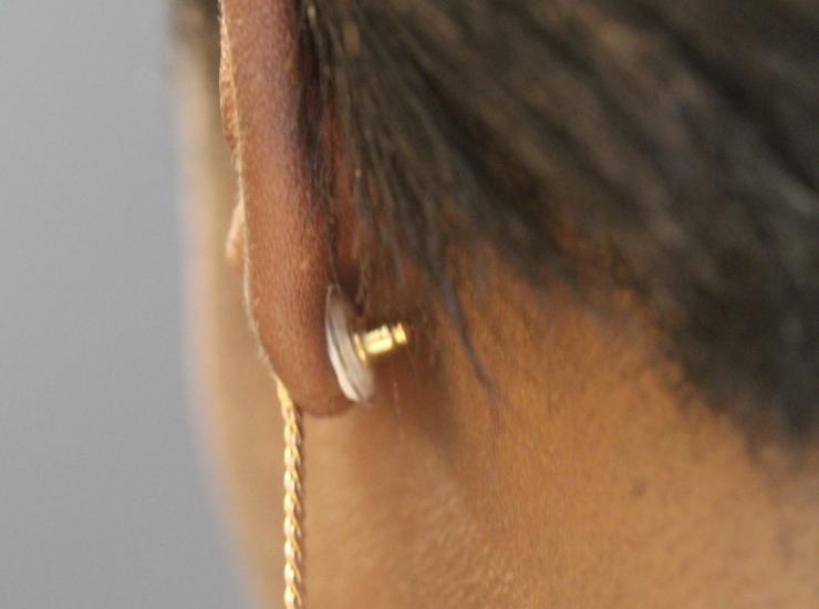 <p>A contraceptive earring patch is shown as it would be worn on a woman’s ear. The white contraceptive patch can be seen attached to the earring back and adhered to the back of the ear. (Credit: Mark Prausnitz, Georgia Tech)</p>