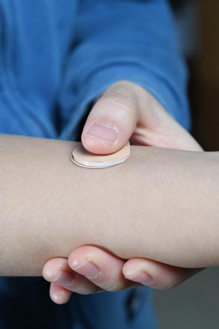 <p>Image shows how an experimental microneedle contraceptive skin patch could be applied to the skin. Designed to be self-administered by women for long-acting contraception, the patch could provide a new family planning option. (Credit: Christopher Moore, Georgia Tech)</p>