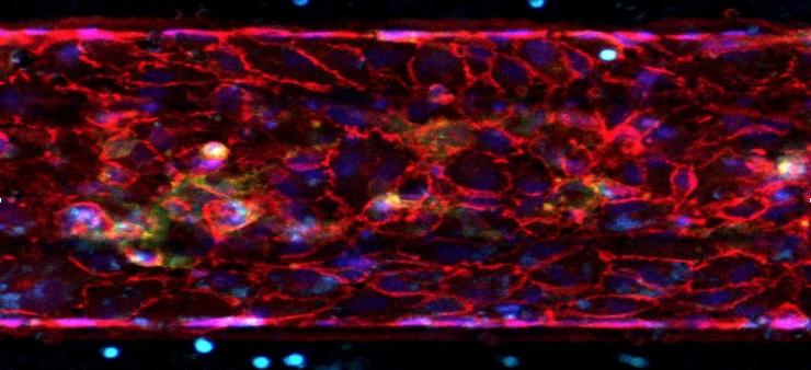 Endothelial cells in artery-on-a-chip