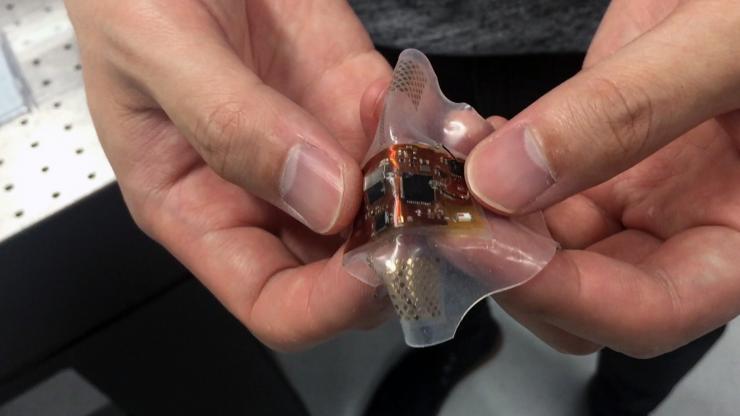 <p>A wireless, wearable monitor built with stretchable electronics could allow comfortable, long-term health monitoring of adults, babies and small children. The monitor is built on a flexible substrate. (Photo: John Toon, Georgia Tech)</p>