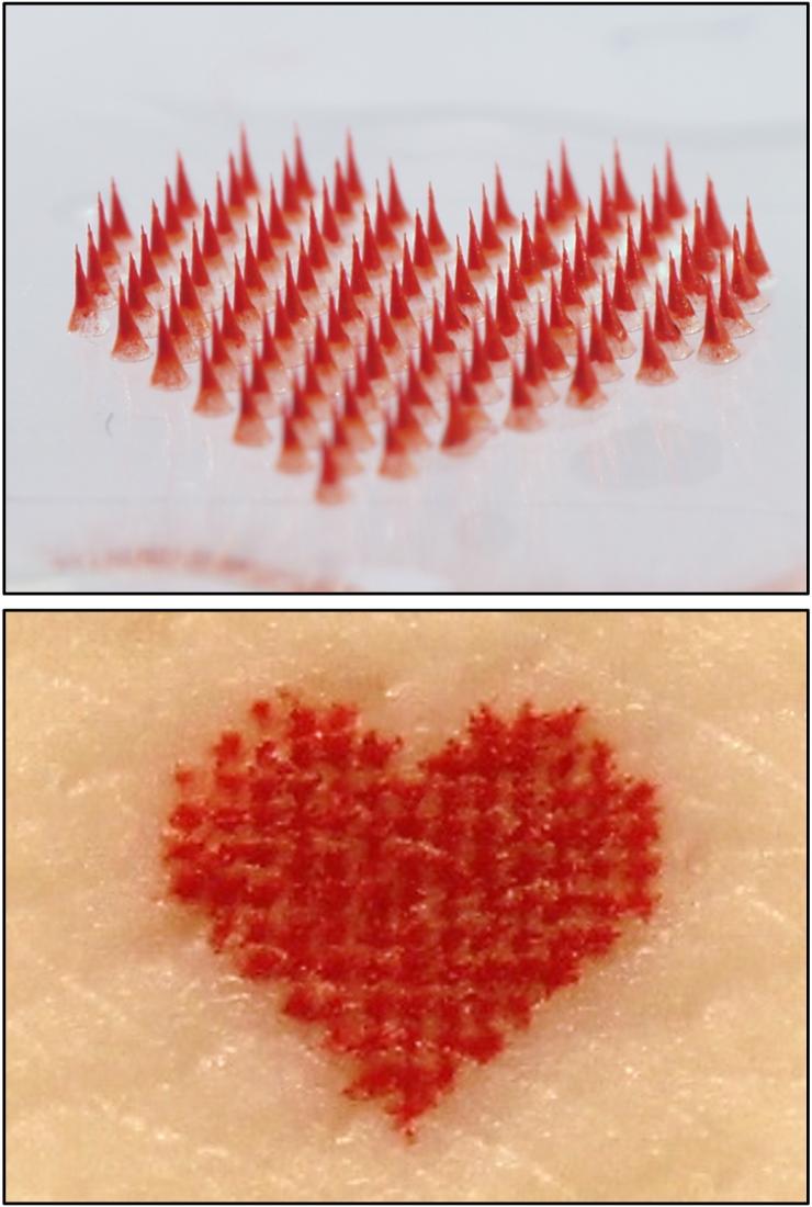 <p>Heart tattoo: microneedle patch (above) and tattoo on skin (below).</p><p>Credit: Song Li, Georgia Tech</p>