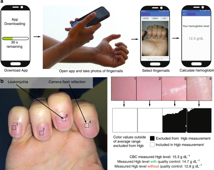 <p>During its development, research engineers spoke about their smartphone app that screens for anemia. Credit: Georgia Tech </p>
