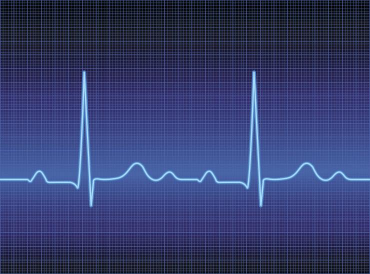 <p>A healthy heart produces electrical signals that coordinate the contraction of muscle fibers. (Credit: iStock photo)</p>