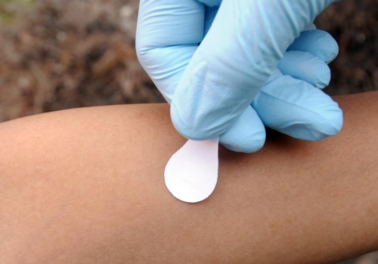 <p>Microneedle patches would be briefly applied to an arm, where the needles would dissolve into the skin, carrying the vaccine with them. (Credit: Gary Meek)</p>
