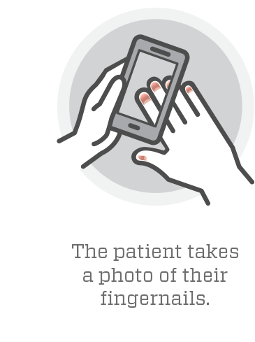 <p>An illustration of how the anemia test smartphone app works. Credit: Lam / Emory / Georgia Tech</p>