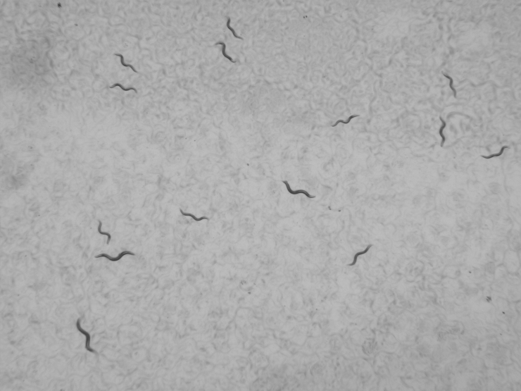 <p>Researcher Wen Xu uses a needle with a microscopic point to inject a <em>C. elegans</em> roundworm with CRISPR DNA. The gene editor helped confirm the sweeping effects of a tiny mutation Georgia Tech scientists have discovered.</p>