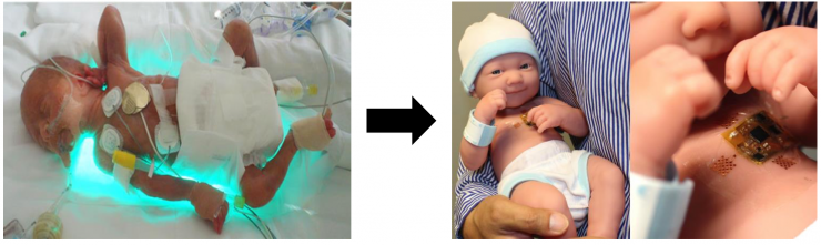 The image to the left displays an infant wearing current monitoring systems used at hospitals today and the image on the right displays a doll wearing the wireless wearable monitoring device Gleason is testing. 