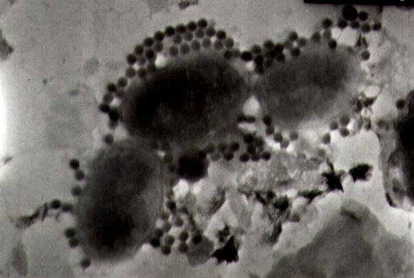 <p>Sometimes the virus to microbial cell (VMR) ratio can be skewed naturally during a (for example) burst of viruses from a bacterial cell. This transmission electron micrograph from a seawater sample off the southwest coast of Norway illustrates a high VMR as a result. (Credit: Willie Wilson, Sir Alister Hardy Foundation for Ocean Science)</p>