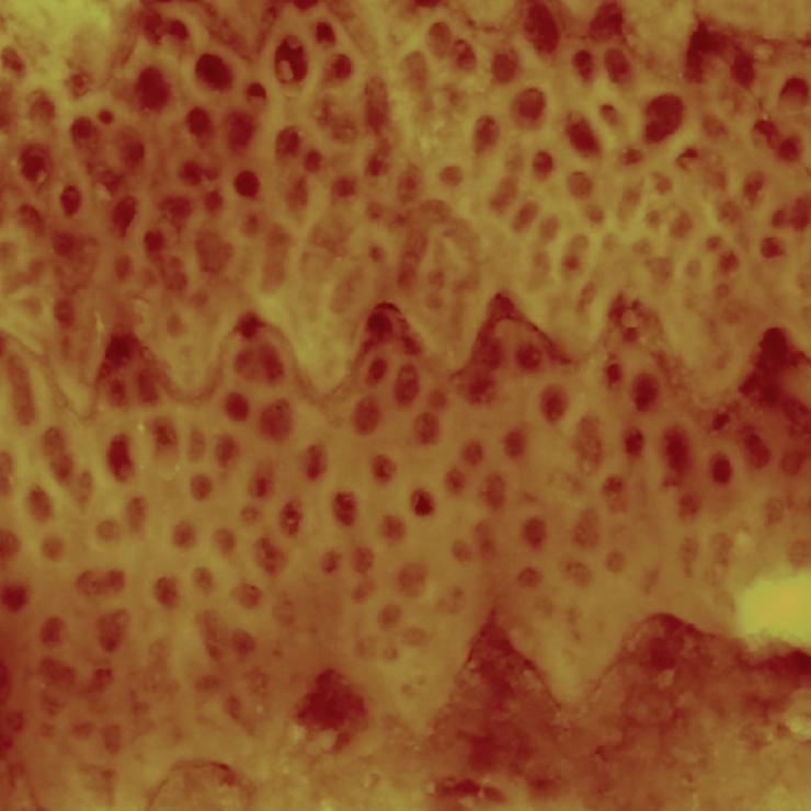 Image shows scale microstructures found on sidewinder snakes. The structures differ from those of other snakes, and researchers believe those differences allow the unique movement of sidewinders on sand. (Credit: Tai-De Li)