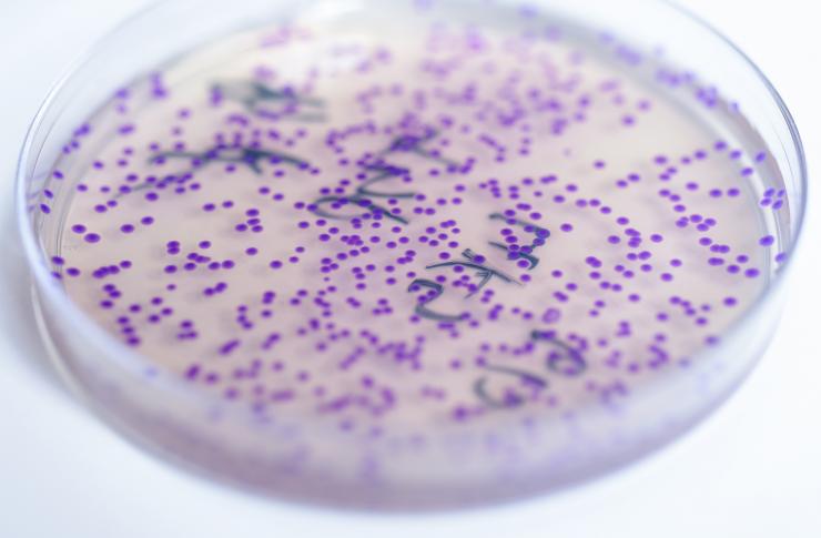 <p>A plate containing E. coli shows a purple pigment in response to levels of zinc. The bacterium could be used to detect nutritional deficiencies in resource-limited areas of the world. Purple would indicate low levels of the micronutrient. (Credit: Rob Felt, Georgia Tech)</p>