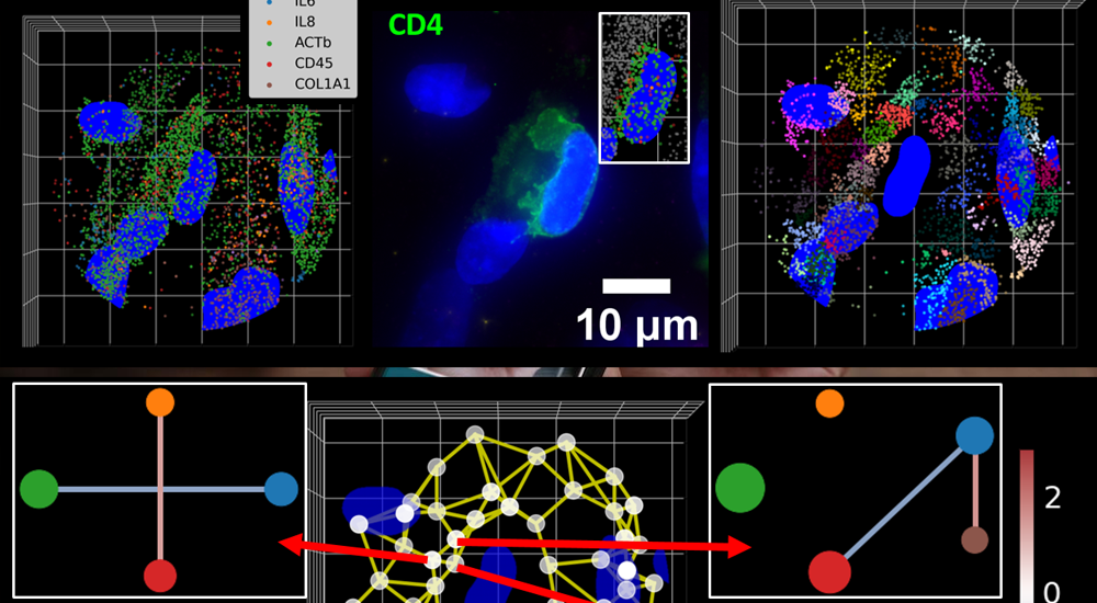 Working Smarter: Improving Personalized Stem Cell Treatments for Kids