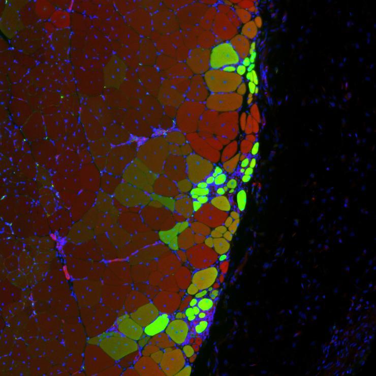 <p> </p>

<p>Hydrogel delivered stem cells called muscle satellite cells integrate to form new muscle strands, in green, along with existing muscle tissue, in red. Yellow strands may descend from existing muscle cells and from delivered MuSCs.</p>