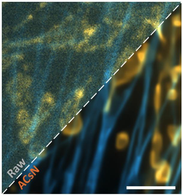 <p>Figure: Dual-color image before and after ACsN denoising of F-actin (cyan) and mitochondria (orange) in fixed bovine pulmonary artery endothelial (BPAE) cells obtained by TIRF microscopy with an exposure time of 2 ms. Scale bar 4 um.</p>