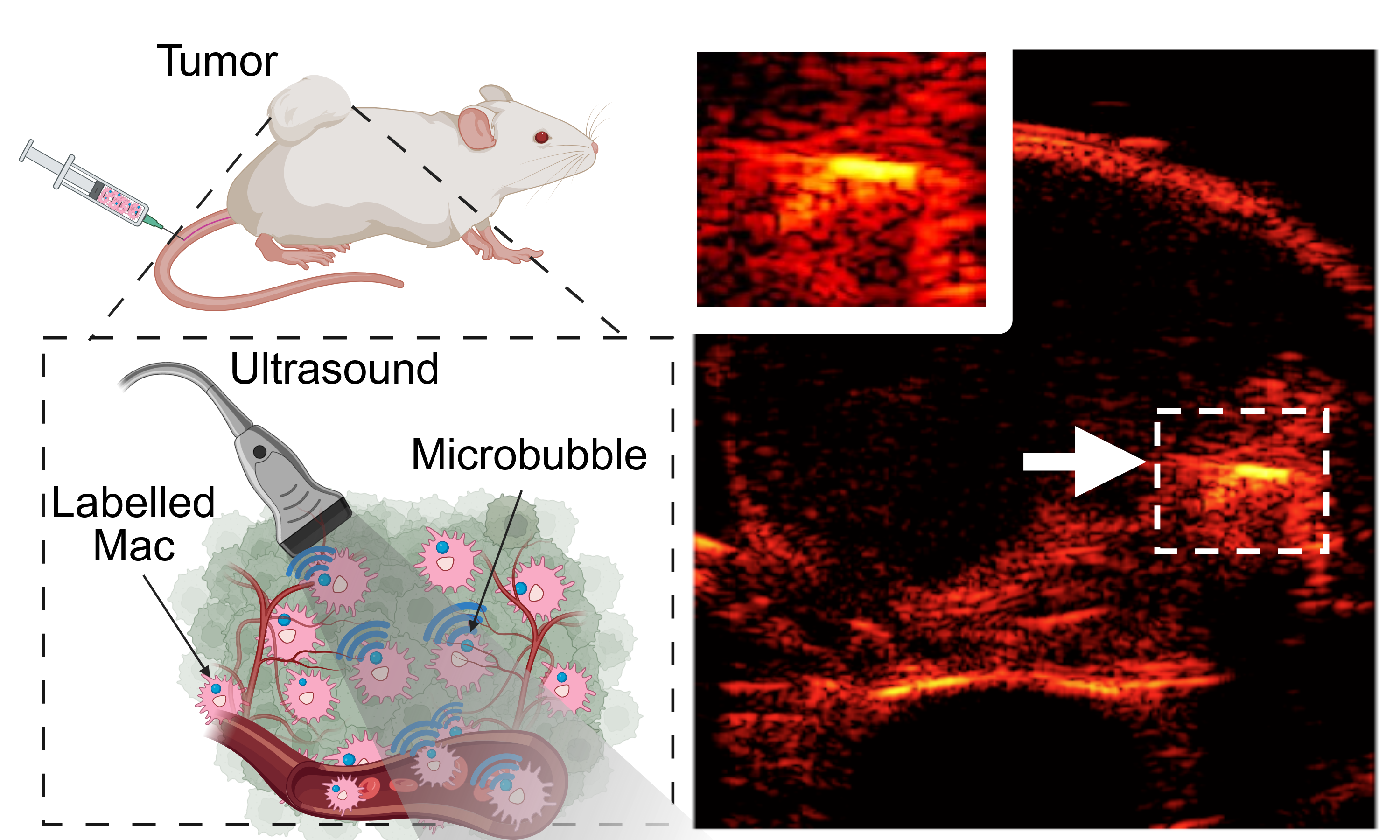 Researchers Use Air-Tagged Macrophages to Transform Cancer Imaging, Diagnosis, and Treatment