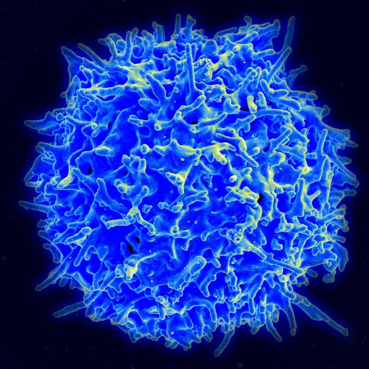 <p>A healthy human T cell. Credit: National Institute of Allergy and Infectious Disease / National Institutes of Health</p>