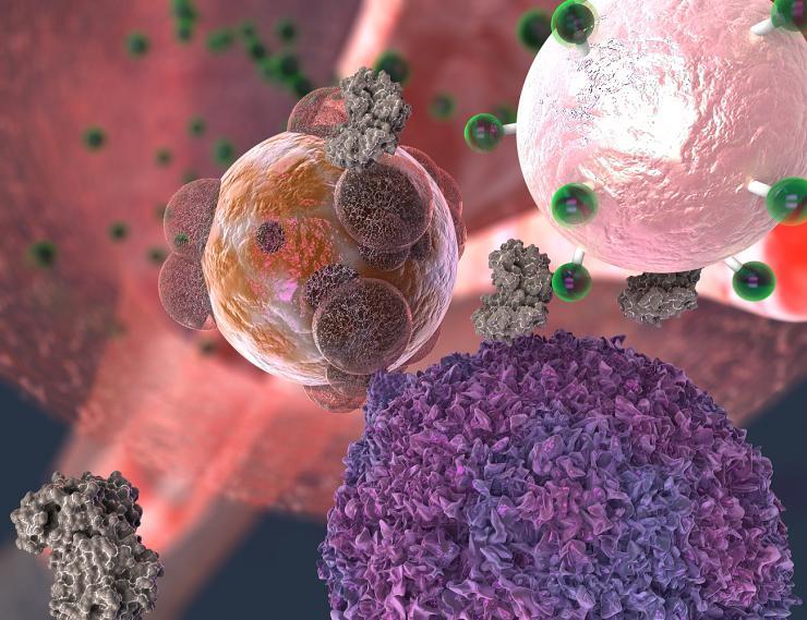 <p>A T cell, here in purple, makes contact with a transplant organ cell, here in reddish brown. The T cell secretes the enzyme granzyme B, here in gray, which attacks the organ cell. But granzyme B also severs fluorescent signal molecules, in green, from the rejection detecting nanoparticle, in light pink. The signal molecules make their way into the urine, where they give off a fluorescent cue. Georgia Tech / EllaMaru Studio (work for hire, all rights GT, free for distribution).</p>