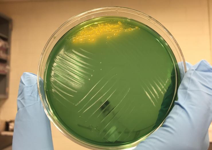 <p>Image shows cholera colonies (yellow) growing on an agar plate. Growth of the bacterium was part of research into the diversity and resourcefulness of the bacterium. (Credit: John Toon, Georgia Tech)</p>