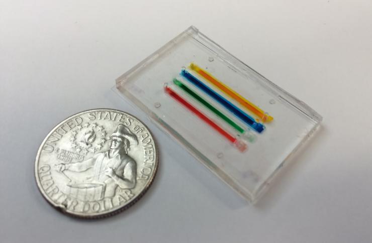 <p>Biomedical engineers from Emory and Georgia Tech have devised a microfluidic device for the diagnosis of bleeding disorders, in which platelets can demonstrate their strength by squeezing two protein dots together using this device.</p>

<p>Photo credit: Emory University / Georgia Tech</p>