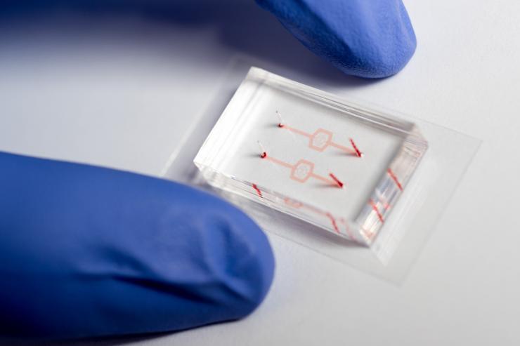 <p>Researchers at Georgia Tech and Emory University fabricated model blood vessel systems that include artificial blood vessels with diameters as narrow as the smallest capillaries in the body. The systems were used to study the activity of white blood cells as they were affected by drugs that tend to make them softer, which facilitates their entry into blood circulation. (Credit: Rob Felt, Georgia Tech)</p>