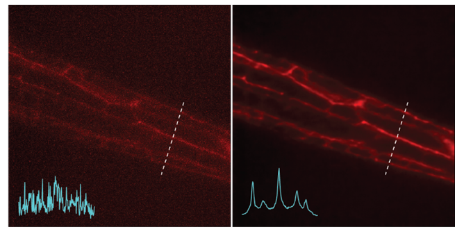 <p><em>Left: Noisy images showing neuronal structures. Right: NIDDL Deep Denoised image of neuronal structures.</em></p>