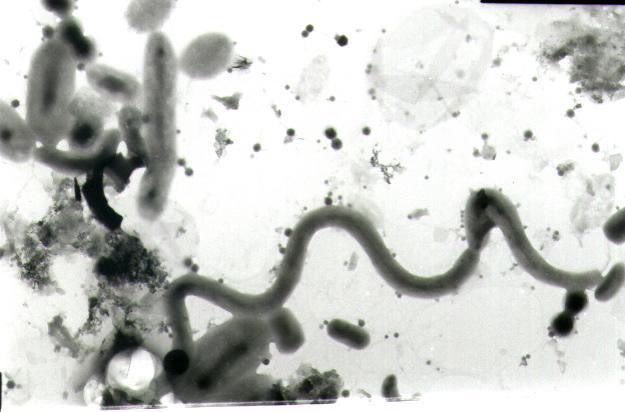 <p>Community of bacteria (larger cells) and viruses (small background dots of varying sizes) from a seawater sample off the southwest coast of Norway. The transmission electron micrograph illustrates an approximate virus to microbial cell (VMR) ratio of 10. (Credit: Willie Wilson, Sir Alister Hardy Foundation for Ocean Science)</p>