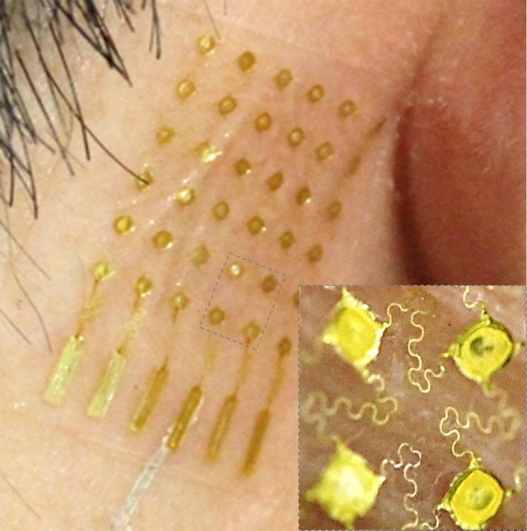 <p>An aerosol-jet printed stretchable, skin-like electrode with an open-mesh structure shown in inset. (Courtesy of Woon-Hong Yeo)</p>