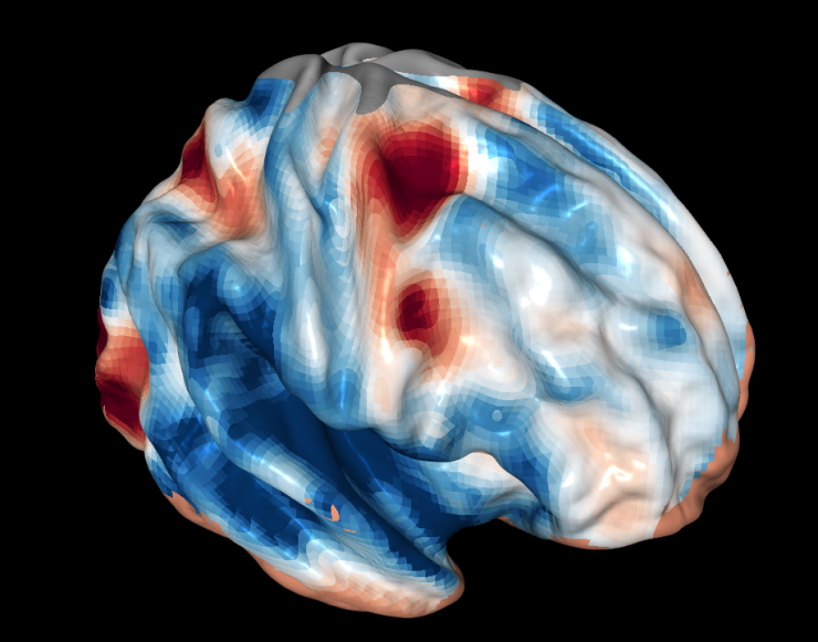 <p>Brain image from a functional MRI scan during tests on the role of the frontal cortex in vision. It's the part of the brain known for being the "thinking cap."</p>