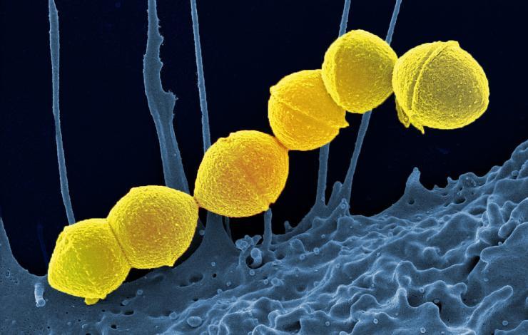 <p><em>Group A Streptococci</em>, colored yellow, are the most common culprits in bacterial upper respiratory infections. Credit: National Institute of Allergy and Infectious Diseases of the NIH</p>
