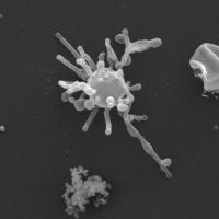 Strange, Tentacled Microbe may Resemble Ancestor of Complex Life