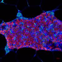 Transplanted pancreatic islet cells in which insulin is shown in red, the cell nucleus in blue, and the blood vessels in aqua.  (Credit: Maria Coronel, Georgia Tech)