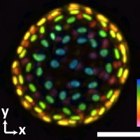 
An image of a colon organoid captured by a new system developed in Shu Jia’s lab that can capture dynamic, 3D information about the lab-grown cultures of tissues in a single image. The raw image was captured in 0.1 seconds. The coloration represents depths of 60 and -60 micrometers from the focal plan to depict the organoid in three dimensions. (Image Courtesy: Shu Jia &amp; Wenhao Liu)
