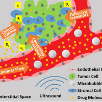 <p>An illustration of improved delivery of anti-cancer drugs to malignancies in the brain. On the left half, focused ultrasound agitates microbubbles, which breach the blood-brain barrier, allowing drug molecules to get through. The forces also stir interstitial fluid to circulate the drug, and they also encourage the drug to cross cell membranes more easily into tumor cells. Credit: Massachusetts General Hospital / Georgia Tech / Arvanitis / Askoxylakis</p>