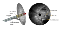 A new kind of catheter designed to give doctors clearer, real-time insight during these life-saving procedures.