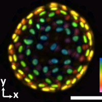 <p>An image of a colon organoid captured by a new system developed in Shu Jia’s lab that can capture dynamic, 3D information about the lab-grown cultures of tissues in a single image. The raw image was captured in 0.1 seconds. The coloration represents depths of 60 and -60 micrometers from the focal plan to depict the organoid in three dimensions. (Image Courtesy: Shu Jia &amp; Wenhao Liu)</p>
