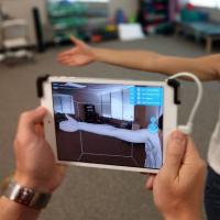 <p>An app and a camera attachment are now all that are needed to check for early onset lymphedema in breast cancer survivors. Credit: LymphaTech / Georgia Tech</p>