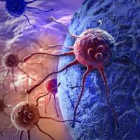 <p>Artist rendering of cancer cells wandering. Credit: Purchased from iStock to illustrate this story. Rights not transferable. </p>