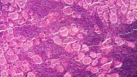 An image of pink mammalian tissue cells under a microscope